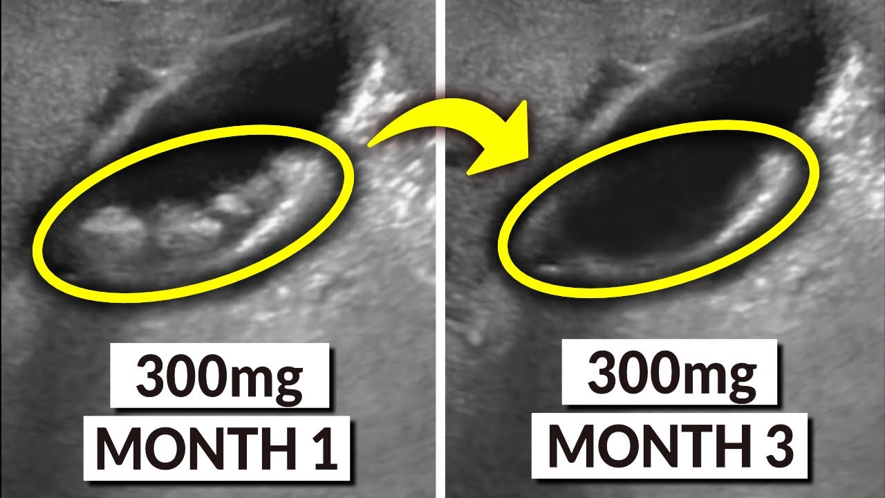 1773325682_maxresdefault-7860107-8801946-jpg